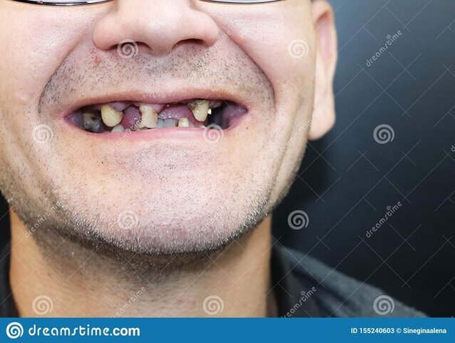 l-uomo-ha-denti-.jpg